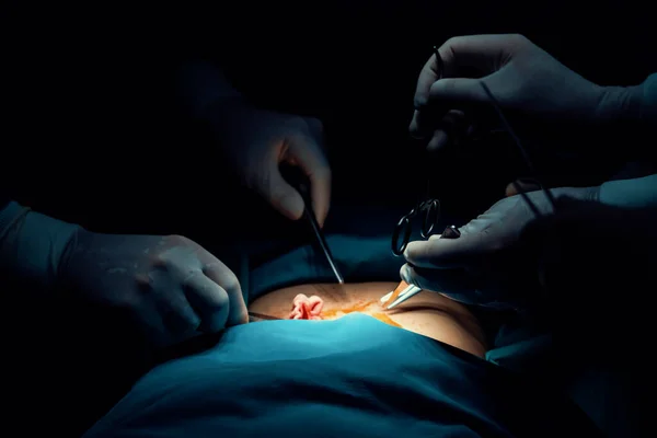 Closeup surgical team performing surgery to patient in sterile operating room. In a surgery room lit by a lamp, a professional and confident surgical team provides medical care to unconscious patient.