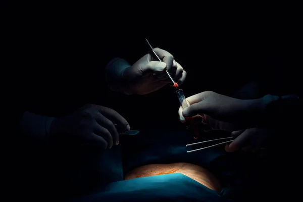 Primo Piano Team Chirurgico Che Esegue Intervento Chirurgico Paziente Sala — Foto Stock