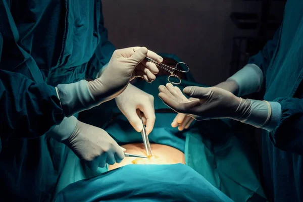 外科团队实施手术的形象 护士向外科医生发放无菌剪刀作为手术室理念的支持与配合 — 图库照片