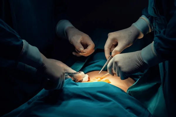 Equipo Quirúrgico Primer Plano Realizando Cirugía Paciente Quirófano Estéril Una —  Fotos de Stock