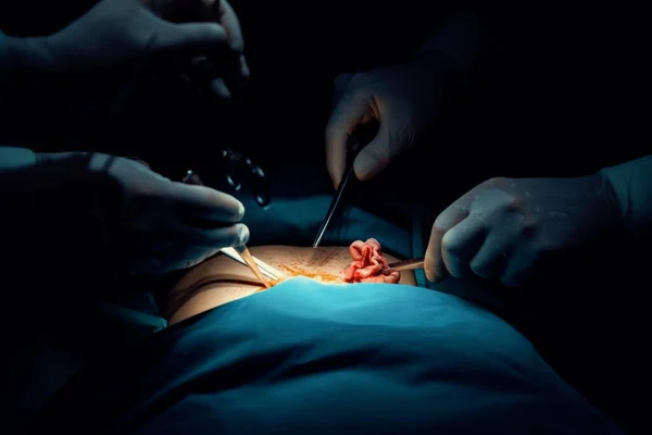 상태의 수술실에서 환자에게 수술을 수행하는 봉합하는 램프에 붙이는 수술실에서 전문적 — 스톡 사진