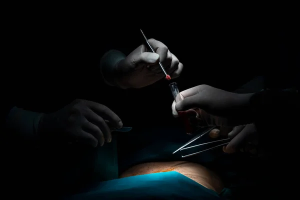 Szekrénysebész Csapat Műti Beteget Steril Műtőben Egy Lámpával Megvilágított Műtőben — Stock Fotó