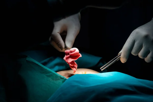 Närbild Kirurgiskt Team Utför Kirurgi Till Patienten Sterila Operationssalen Ett — Stockfoto