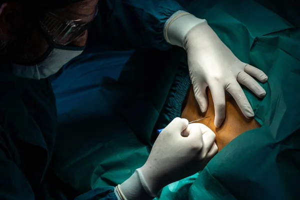 在用现代外科设备进行无菌手术室的手术前 外科医生用注射器向病人注射麻醉 由专业和自信的外科医生进行的医疗手术 — 图库照片