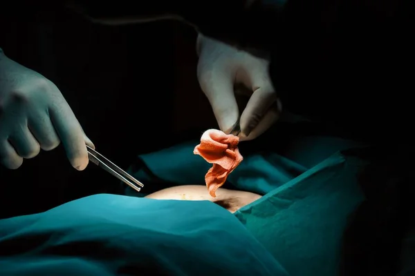 Steril Ameliyathanede Hastaya Ameliyat Yapan Cerrahi Ekip Bir Lambanın Yaktığı — Stok fotoğraf