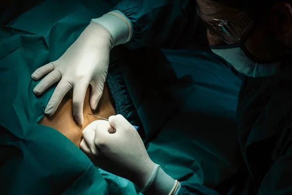 Хирург Вводит Пациента Анестезию Шприцем Перед Операцией Стерильной Операционной Современным — стоковое фото