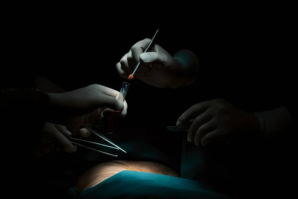 Detailní Chirurgický Tým Provádějící Operaci Pacientovi Sterilním Operačním Sále Ordinaci — Stock fotografie