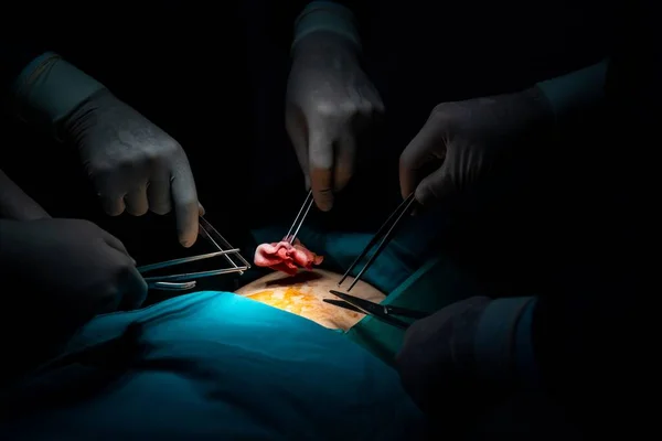 Closeup Chirurgische Team Het Uitvoeren Van Een Operatie Aan Patiënt — Stockfoto