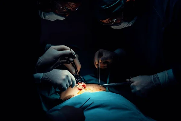 Chirurgický Tým Provádějící Operaci Pacientovi Sterilním Operačním Sále Ordinaci Osvětlené — Stock fotografie