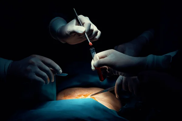 Χειρουργική Ομάδα Που Εκτελεί Χειρουργική Επέμβαση Ασθενή Αποστειρωμένο Χειρουργείο Μια — Φωτογραφία Αρχείου