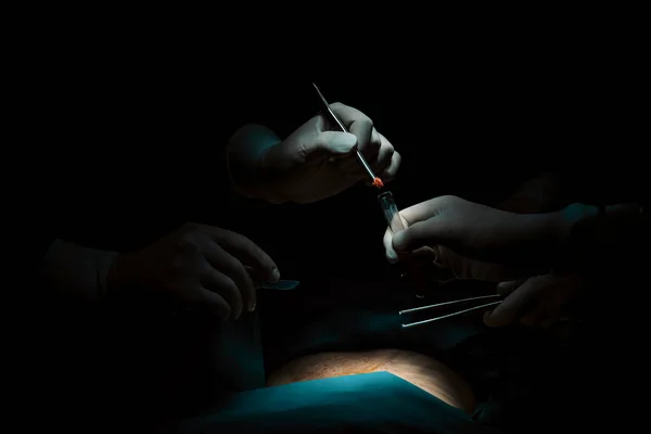 在无菌手术室为病人实施手术的闭锁外科小组 在由一盏灯点亮的手术室里 一个专业而自信的外科小组为不省人事的病人提供医疗护理 — 图库照片