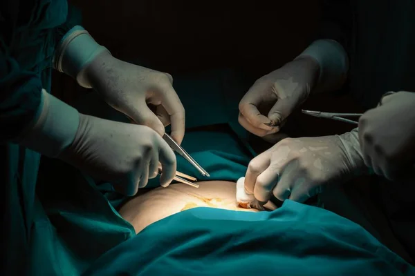Fechar Equipe Cirúrgica Que Realiza Cirurgia Para Paciente Sala Cirurgia — Fotografia de Stock