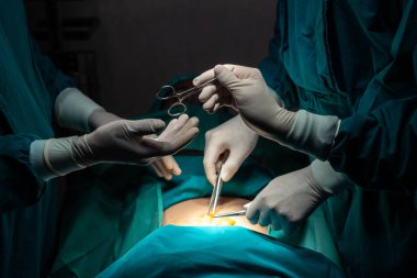 Ameliyat ekibinin görüntüsü, ameliyat odası konseptinde destekleyici ve işbirlikçi olarak steril makası cerraha veriyor..