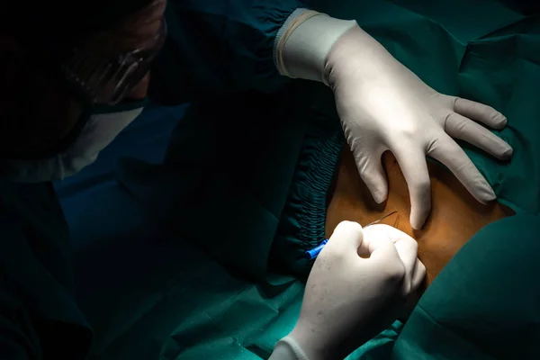 外科医は 現代の外科機器と滅菌手術室で手術を行う前に 患者に注射器で麻酔を注入します 専門家と自信のある外科医による医療手術 — ストック写真