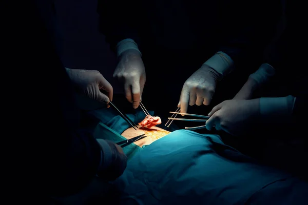 Closeup surgical team performing surgery to patient in sterile operating room. In a surgery room lit by a lamp, a professional and confident surgical team provides medical care to unconscious patient.