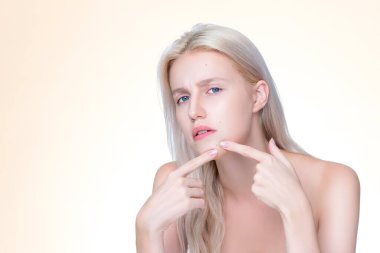 Acne problem troubling closeup personable worried woman with natural beauty skin checking her face squeezing pimple spots in isolated background. Copyspace for blemish skincare treatment problem.