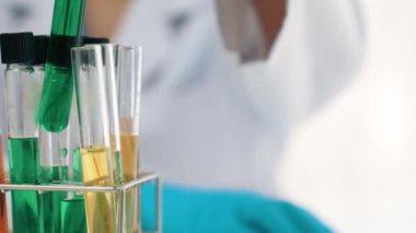 Laboratuvar araştırmacısı yeni bir ilaç geliştirir ya da tedavi eder. Laboratuvar tüpünde renkli kimyasal sıvı kullanır. Bilimsel veya kimya uzmanlığı ve laboratuvar ekipmanları ile sağlık hizmetlerinin teknolojik gelişimi. Katı.