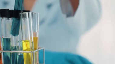 Laboratuvar araştırmacısı yeni bir ilaç geliştirir ya da tedavi eder. Laboratuvar tüpünde renkli kimyasal sıvı kullanır. Bilimsel veya kimya uzmanlığı ve laboratuvar ekipmanları ile sağlık hizmetlerinin teknolojik gelişimi. Katı.
