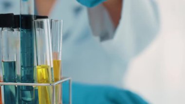 Laboratuvar araştırmacısı yeni bir ilaç geliştirir ya da tedavi eder. Laboratuvar tüpünde renkli kimyasal sıvı kullanır. Bilimsel veya kimya uzmanlığı ve laboratuvar ekipmanları ile sağlık hizmetlerinin teknolojik gelişimi. Katı.