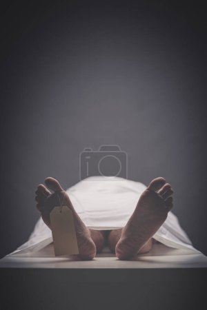 Foto de Cadáver con pie en una mesa de la morgue - Imagen libre de derechos
