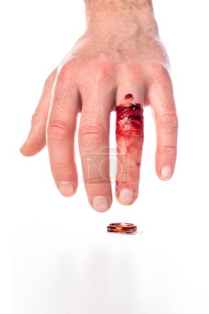 Téléchargez les photos : Main avec doigt sanglant et alliance sur fond blanc - en image libre de droit