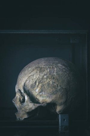 Foto de Cráneo humano real en caja de metal fondo oscuro - Imagen libre de derechos