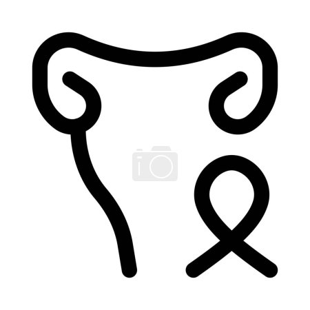 Illustration for Uterine cancer in female isolated on a white background - Royalty Free Image