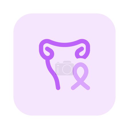 Illustration for Uterine cancer in female isolated on a white background - Royalty Free Image