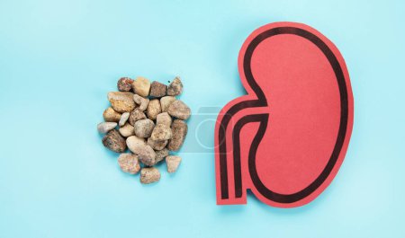 Photo for Kidney and differents pills on blue background. Organ diseases and treatment. - Royalty Free Image