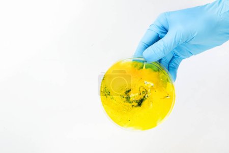 Foto de Mano en guante azul sosteniendo placa de Petri con bacteria. Microbiología sience. Vista superior. - Imagen libre de derechos