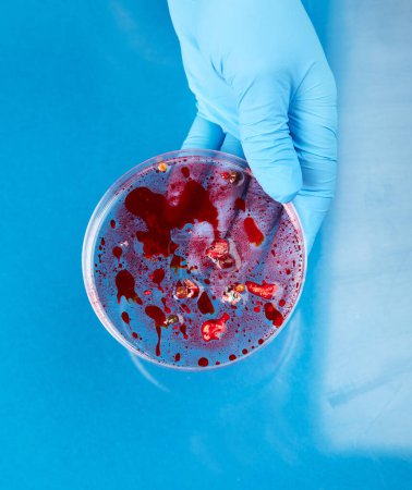 Photo for Hand in blue glove holding  petri dish with bacterium . Microbiology sience. Top  view. - Royalty Free Image