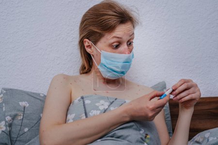 Foto de Mujer joven con varicela usando máscara médica mira el termómetro con sorpresa - Imagen libre de derechos