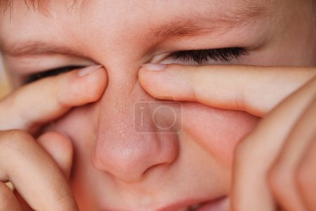 Téléchargez les photos : Allergique garçon grattant ses yeux vue rapprochée - en image libre de droit