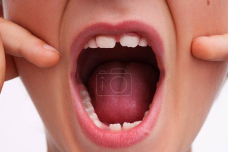 Foto de Boca abierta de un niño con un diente de bebé suelto - Imagen libre de derechos