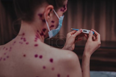 Foto de Mujer joven con varicela usando una máscara médica mirando el termómetro - Imagen libre de derechos