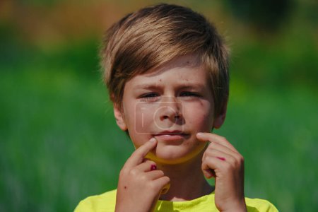 Foto de Retrato al aire libre de niño con varicela - Imagen libre de derechos