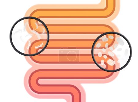 Téléchargez les photos : Illustration schématique des intestins humains - en image libre de droit
