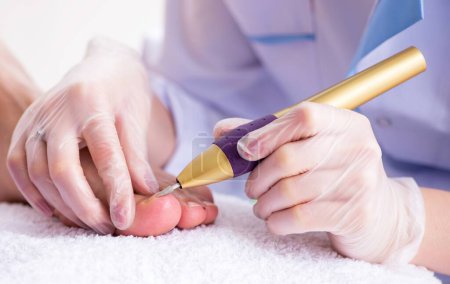 Photo for The podiatrist treating feet during procedure - Royalty Free Image