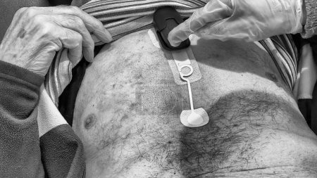 Foto de Un anciano en el hospital mientras le aplicaban su Holter. - Imagen libre de derechos