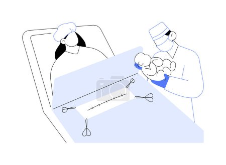 Téléchargez les illustrations : Illustration vectorielle abstraite de concept de césarienne. Processus d'accouchement chirurgical du bébé, processus de travail, césarienne, procédure gynécologique, idée d'accouchement métaphore abstraite. - en licence libre de droit