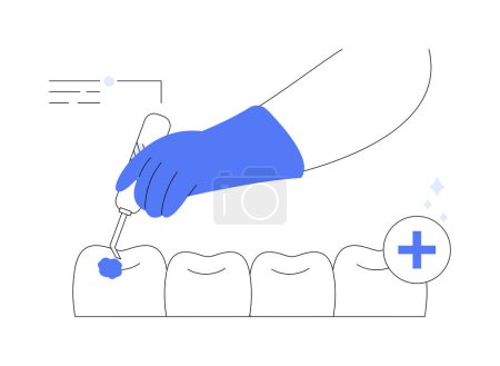 Illustration vectorielle abstraite de concept de mastics à base de fissure. Dentiste pédiatrique utilisant des mastics de fissure pendant le traitement préventif des dents, prévention de la carie dentaire, métaphore abstraite de la médecine buccale.
