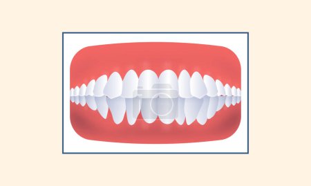 Illustration for Crowding Human Teeth Icon Over Yellow Background. - Royalty Free Image