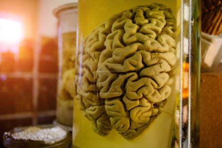 Téléchargez les photos : Cerveau humain dans un bocal en verre avec du formaldéhyde pour des études médicales
. - en image libre de droit