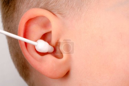 Téléchargez les photos : Ear stick and baby ear, macro - en image libre de droit