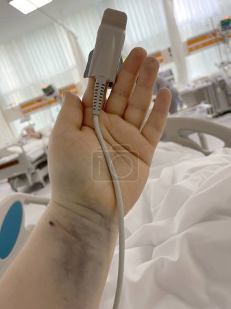 Foto de Mano del paciente con sonda de oximetría de pulso en la unidad de cuidados intensivos del hospital - Imagen libre de derechos