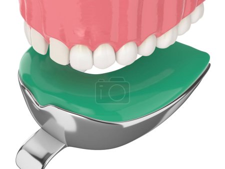 Photo for 3d render of upper jaw with dental impression tray over white background - Royalty Free Image