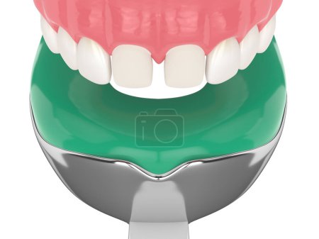 Téléchargez les photos : 3d rendu de la mâchoire supérieure avec plateau d'impression dentaire sur fond blanc - en image libre de droit