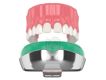 Téléchargez les photos : 3d rendu de la mâchoire supérieure avec plateau d'impression dentaire sur fond blanc - en image libre de droit