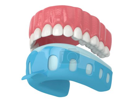 Foto de 3d renderizado de mandíbula superior con bandeja de impresión dental sobre fondo blanco - Imagen libre de derechos
