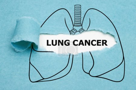 Texto Cáncer de pulmón que aparece detrás del papel azul roto en el concepto de pulmones humanos dibujados.